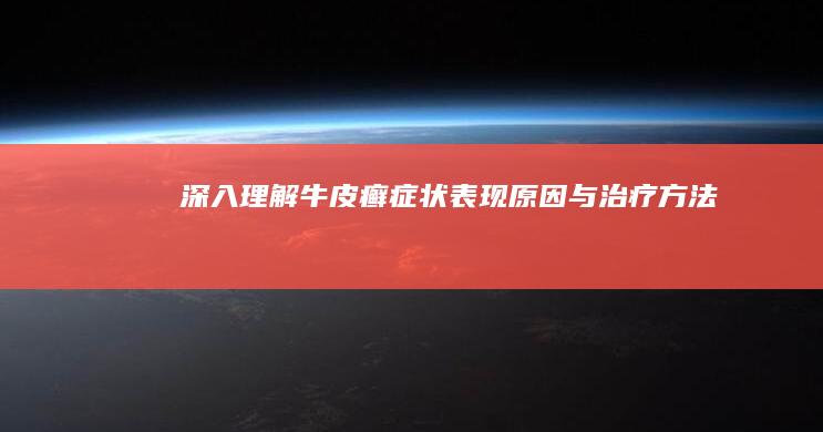 深入理解牛皮癣症状：表现、原因与治疗方法